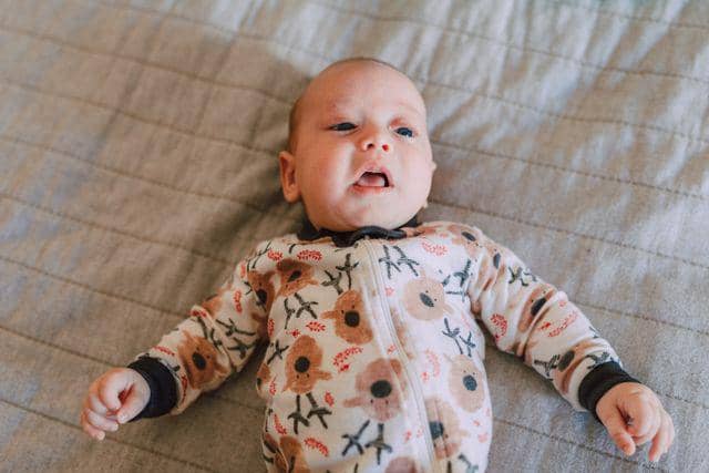 Kondisi pada bayi yang sering dikira berbahaya padahal normal