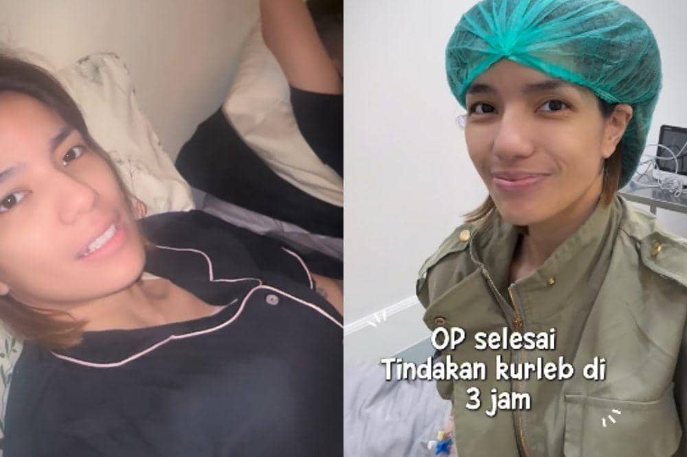 Sheila Marcia Lakukan Operasi Payudara: Sudah Tak Menyusui Lagi