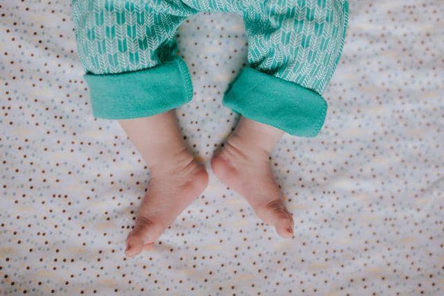 Kondisi pada bayi yang sering dikira berbahaya padahal normal