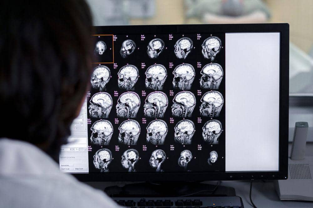 ct scan