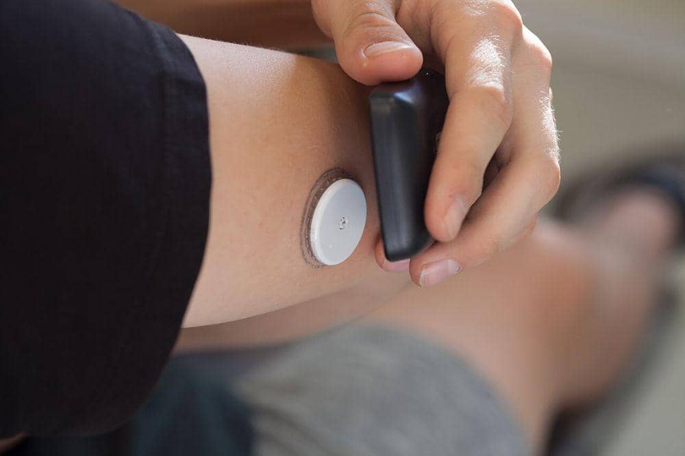 Flash glucose monitor (FGM).