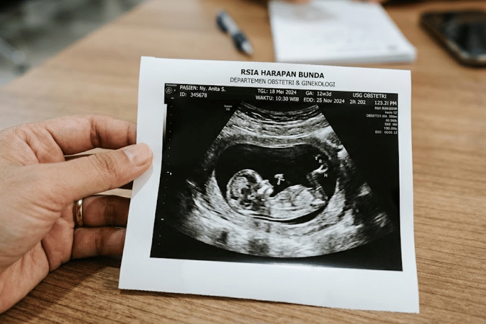 Janin Terlilit Tali Pusar, Haruskah Langsung Caesar?