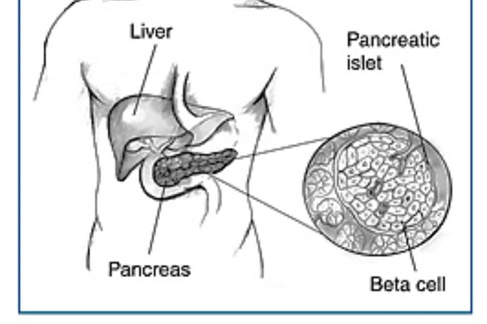 Produksi insulin berlebih