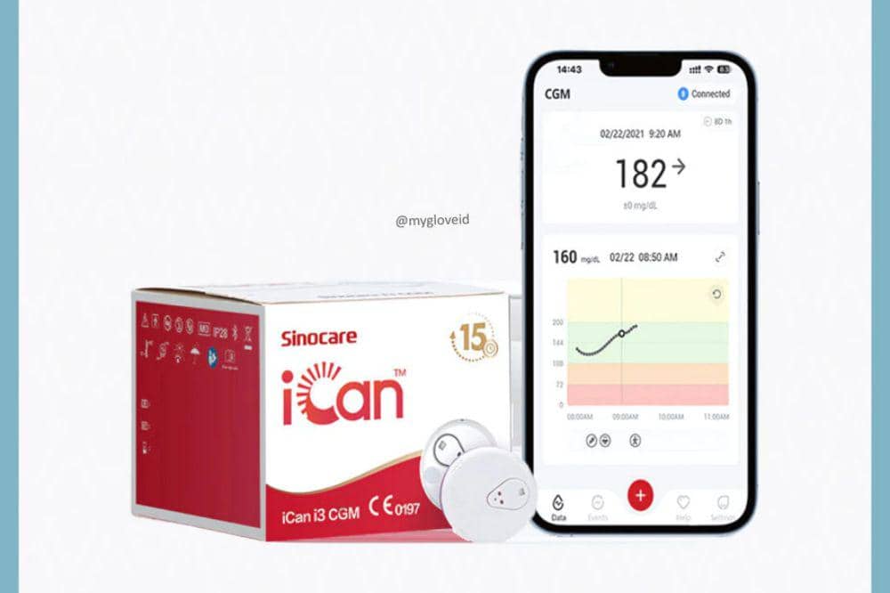 Continuous glucose monitor (CGM)