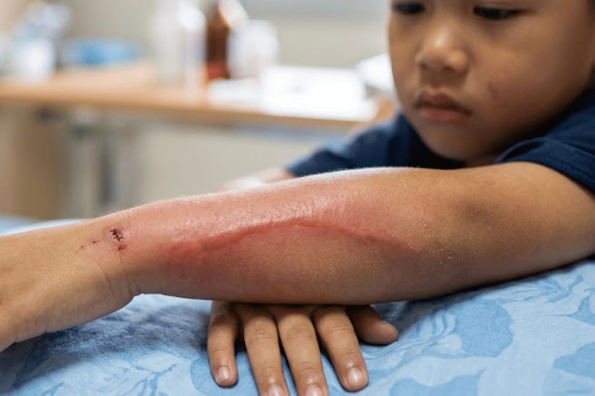 Jika garis merah terus muncul, segera periksa ke dokter