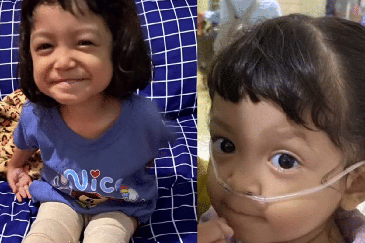 Haru! Perjuangan Anak Jalani Terapi Demi Bisa Berjalan Normal