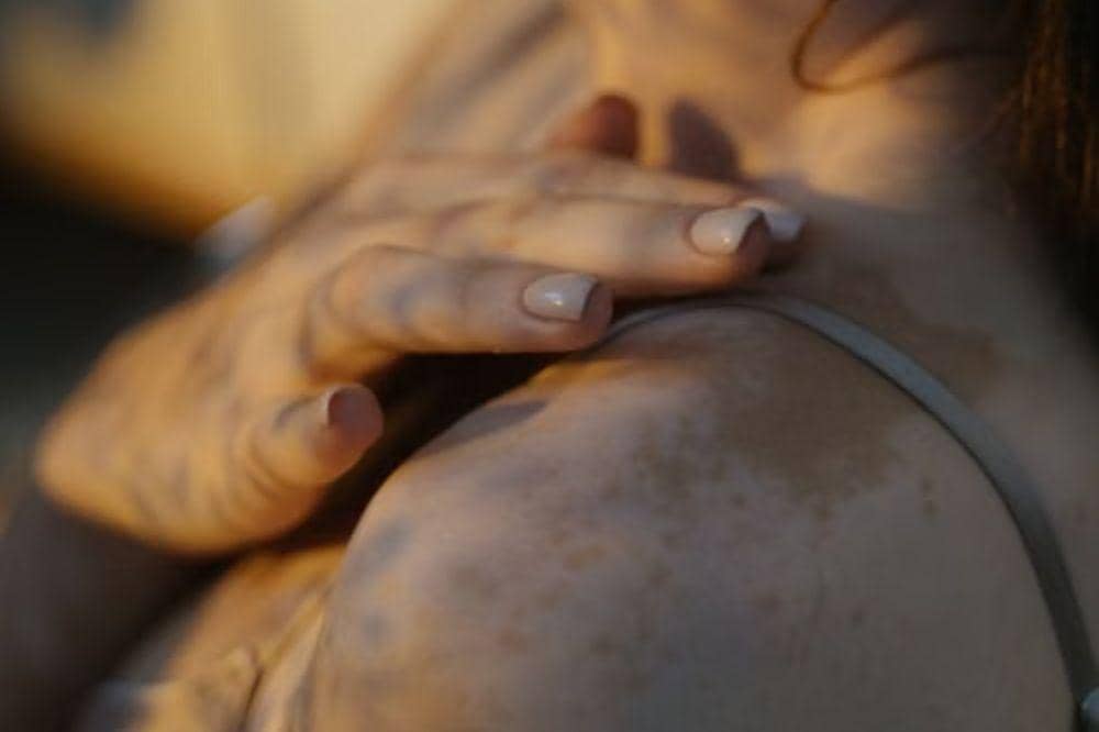 6 Penyebab Autoimun pada Perempuan yang Jarang Disadari