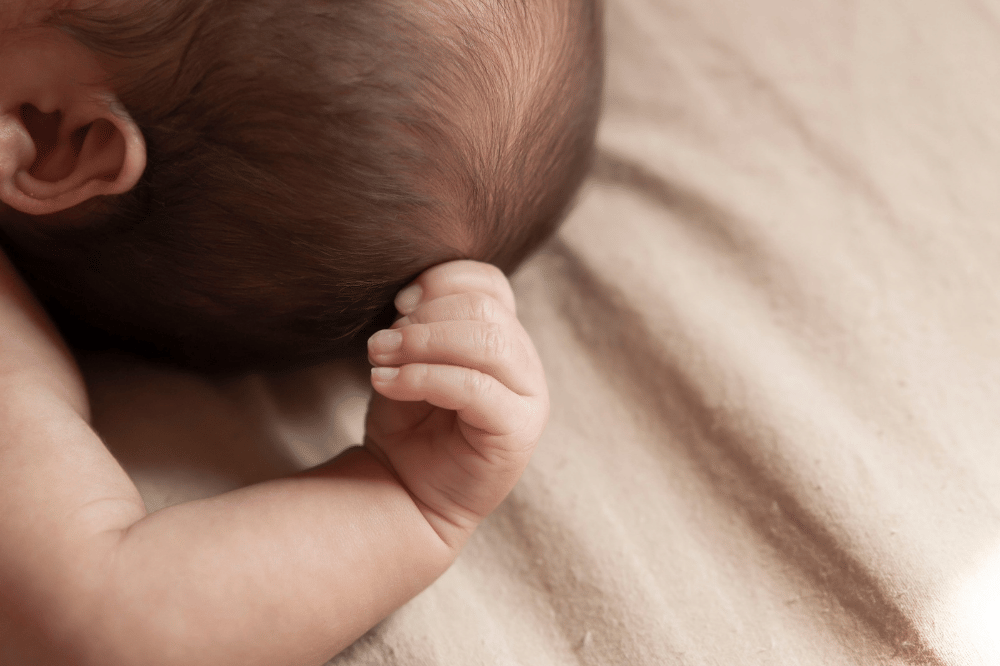 5 Ciri-Ciri Scabies pada Bayi yang Perlu Diperhatikan