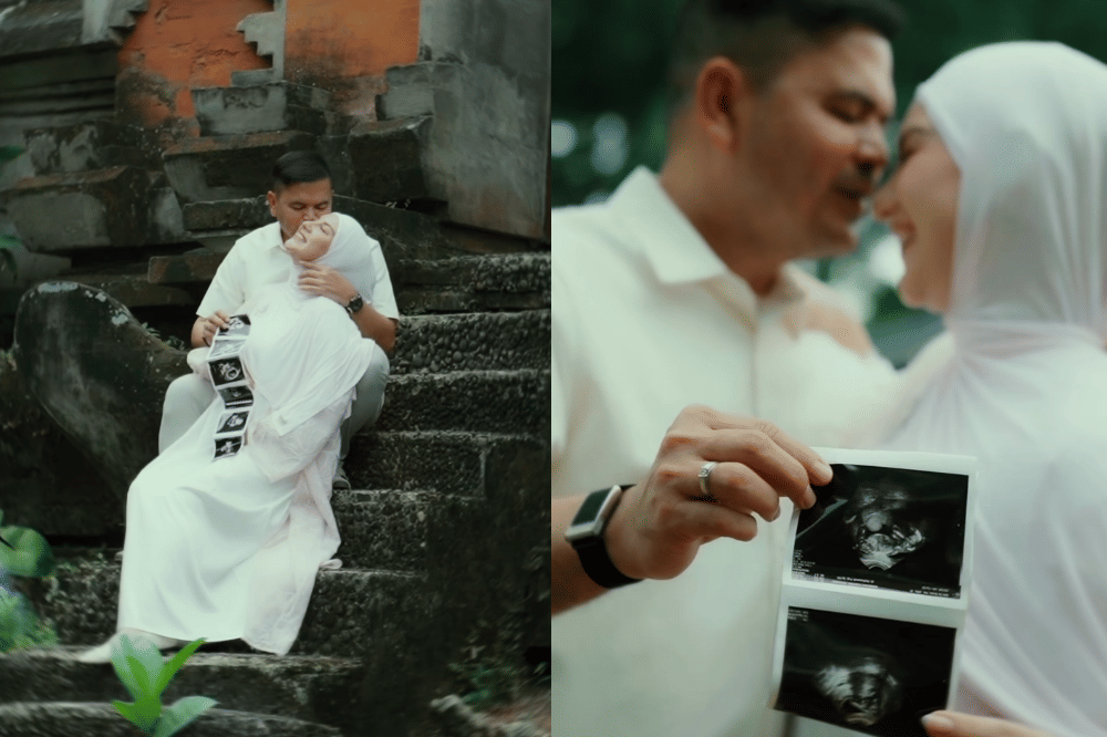 Irish Bella Hamil Anak Pertama dari Pernikahan dengan Haldy Sabri