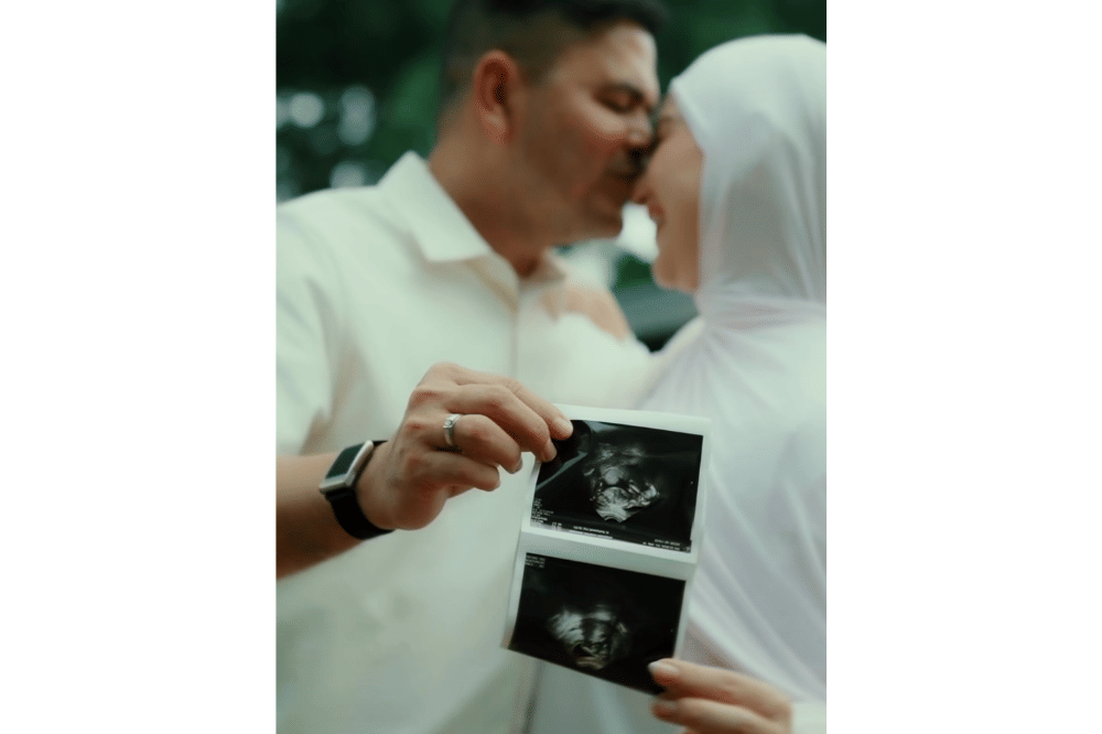Irish Bella hamil anak pertama dari pernikahannya dengan Haldy Sabri