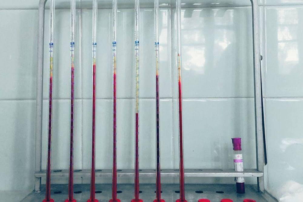 Tes ESR (Erythrocyte Sedimentation Rate)