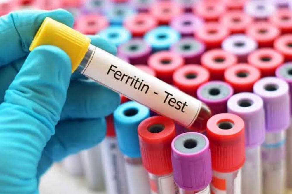 Tes Ferritin