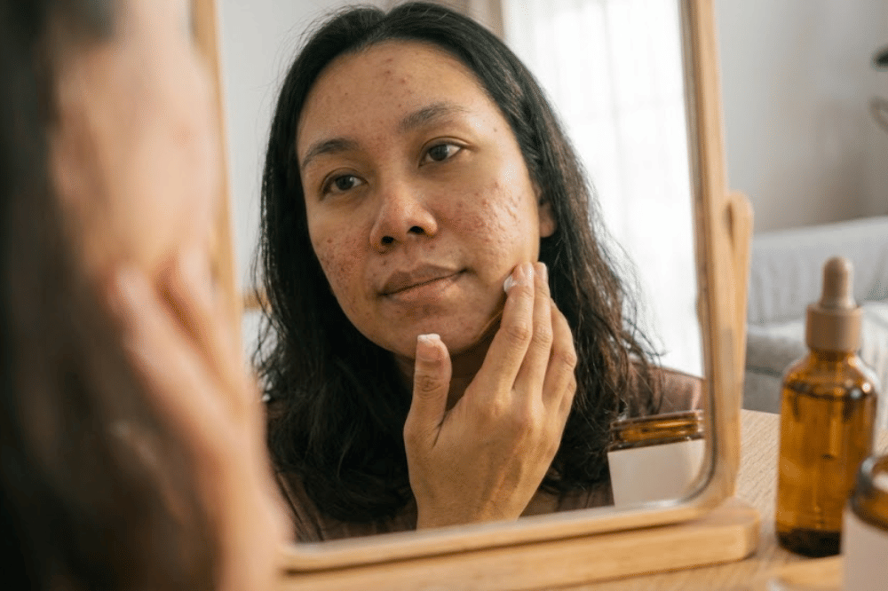 Memperkuat skin barrier menggunakan peptide