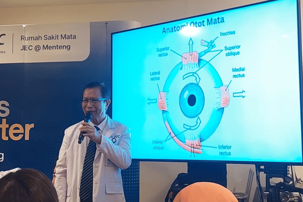 Mata juling di operasi atau tidak tergantung dengan kondisi mata pasien