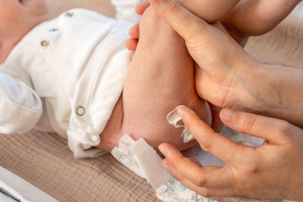 Cara merawat luka anak agar tidak berbekas
