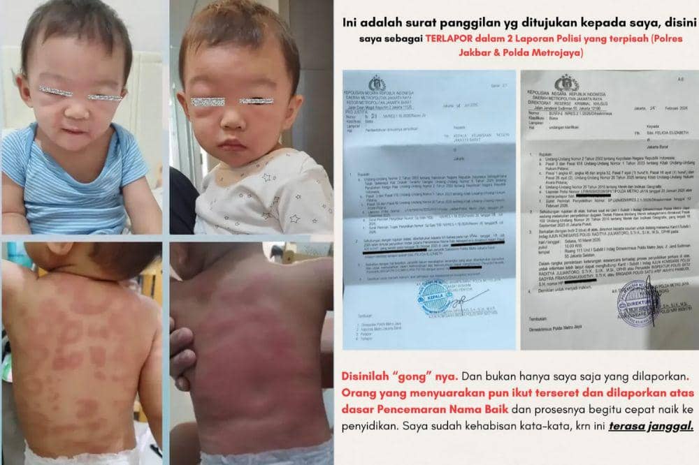 Dari Pelapor Jadi Terlapor, Kisah Baby Kai Korban Roti Gluten Free Palsu