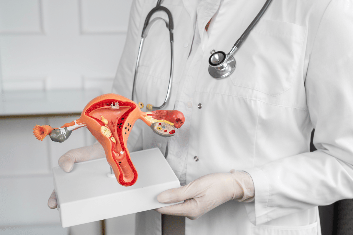 Pengaruh PMOS Terhadap Dinding Rahim, Ini Penjelasan Dokter!