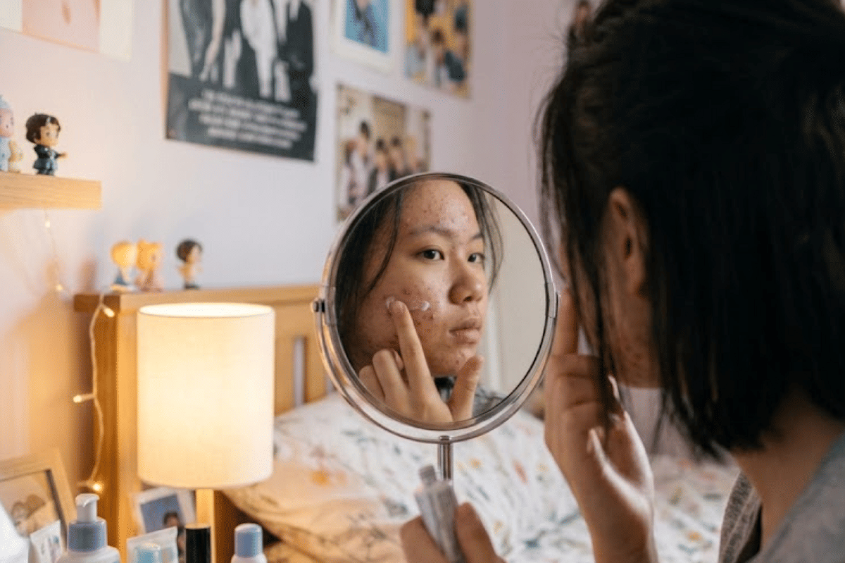 Jangan keseringan mengganti produk skincare, karena membuat iritasi