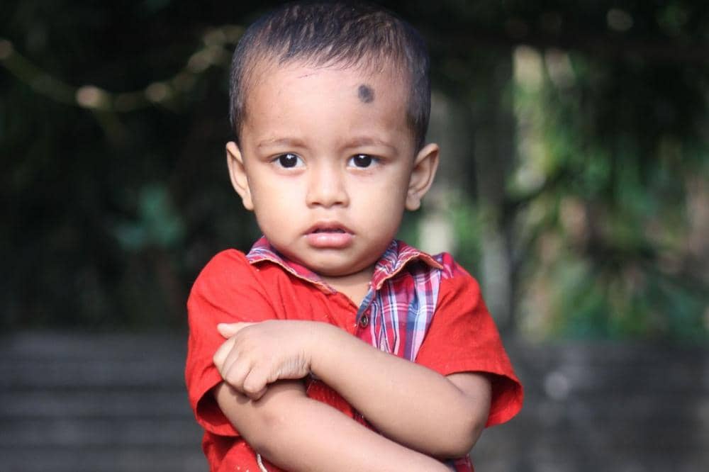 Bahaya cacing tambang pada anak saat barefoot di rumput sebabkan ruam Serpiginious yang gatal