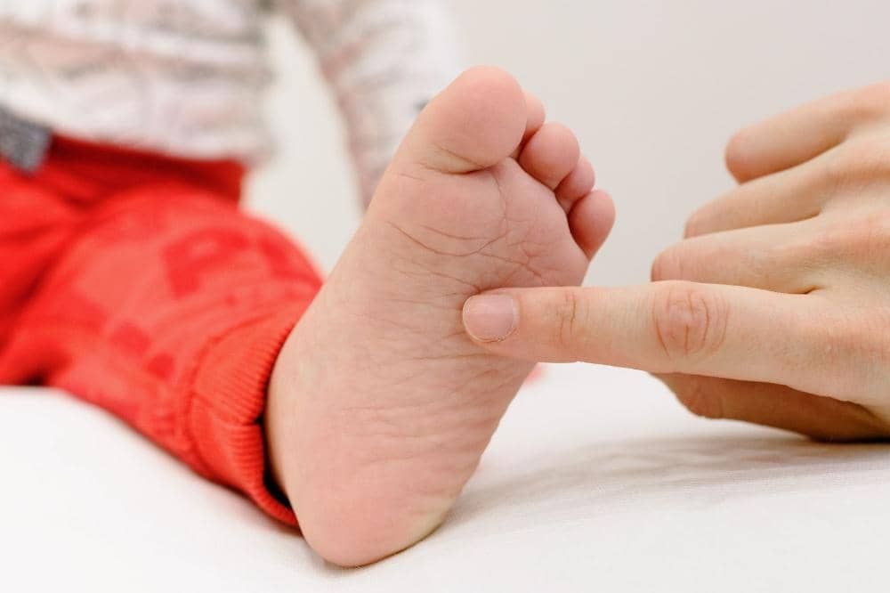 Bahaya cacing tambang pada anak saat barefoot di rumput memicu reaksi gatal pada kulit