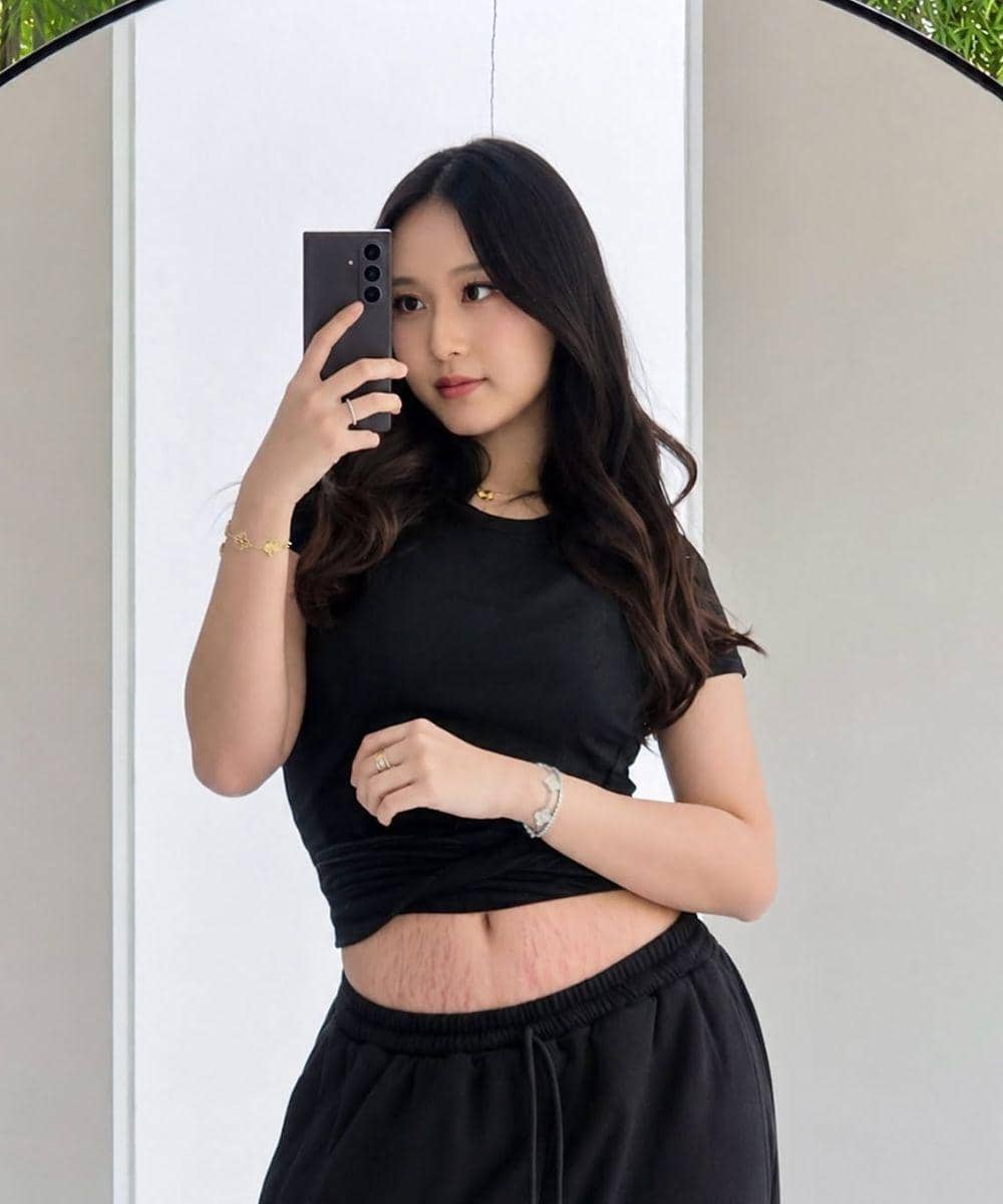 Nita Vior Pamer Perut Penuh Stretch Mark, Disebut Prakarya Vinica (1).jpg