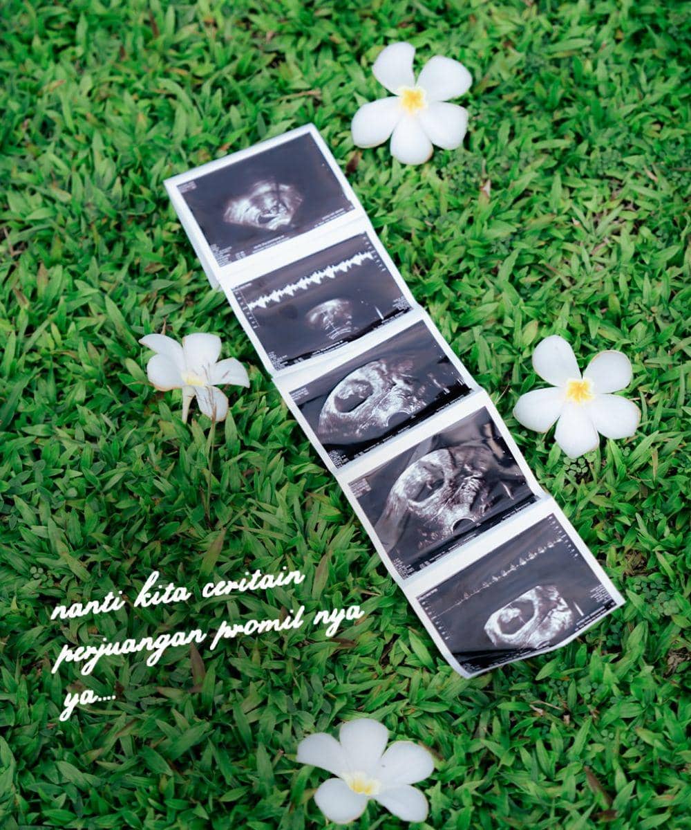 Idap PCOS, Irish Bella Jalani Program IVF di Malays (1).jpg