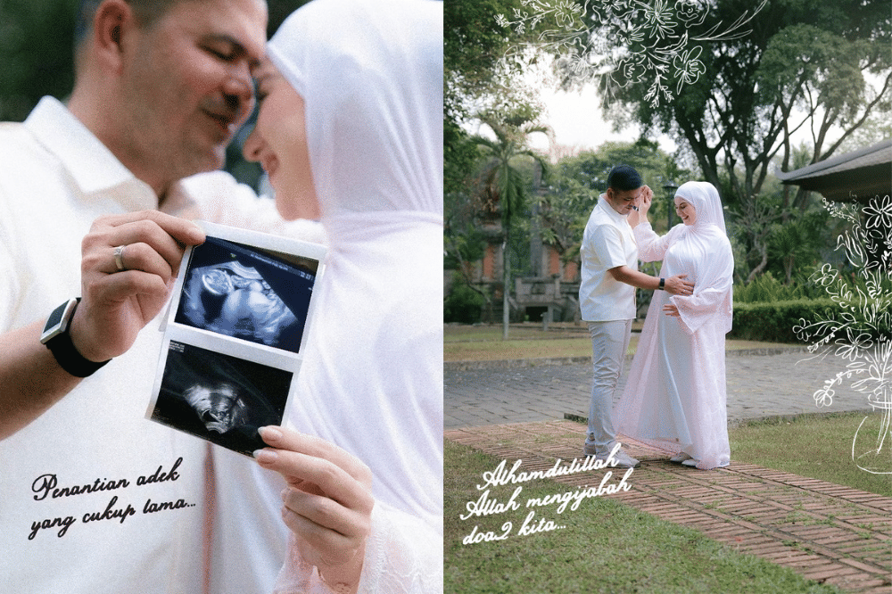 Irish Bella Berhasil Hamil Anak Ke-3 Lewat Program Bayi Tabung
