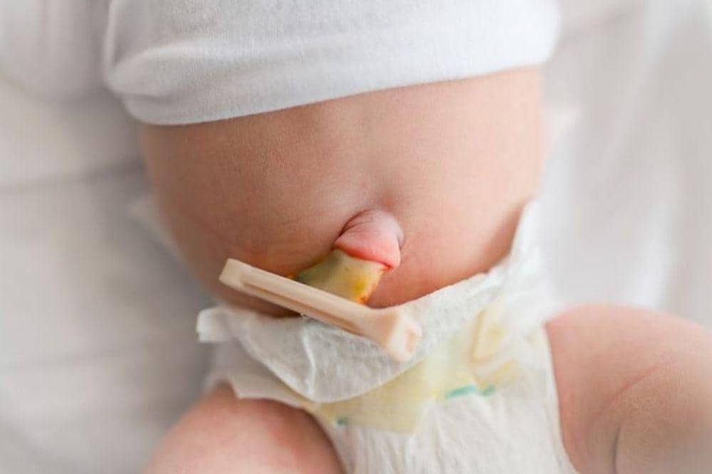 Kapan tali pusar bayi lepas?