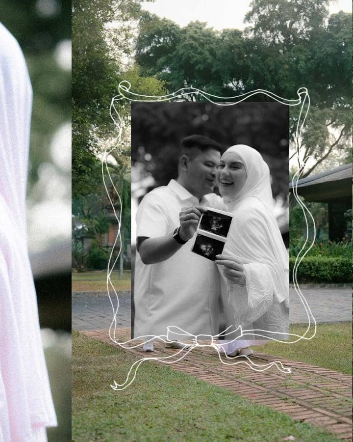 Irish Bella berhasil hamil anak ketiga lewat program bayi tabung