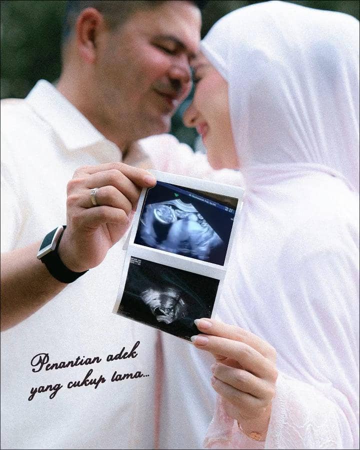 Irish Bella berhasil hamil anak ketiga lewat program bayi tabung