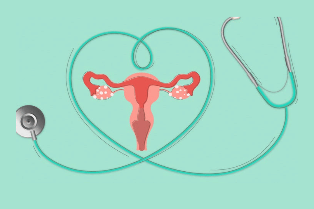 Setelah Operasi Miom, Kista, atau Endometriosis, Kapan Boleh Promil?