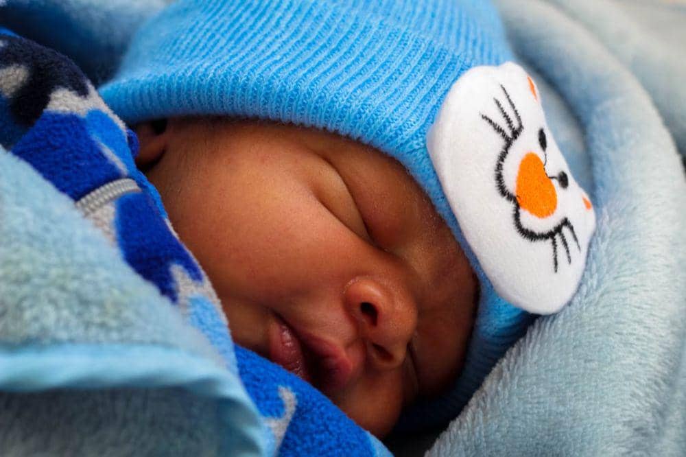 Amati arah penyebaran warna kuning pada kulit si Kecil