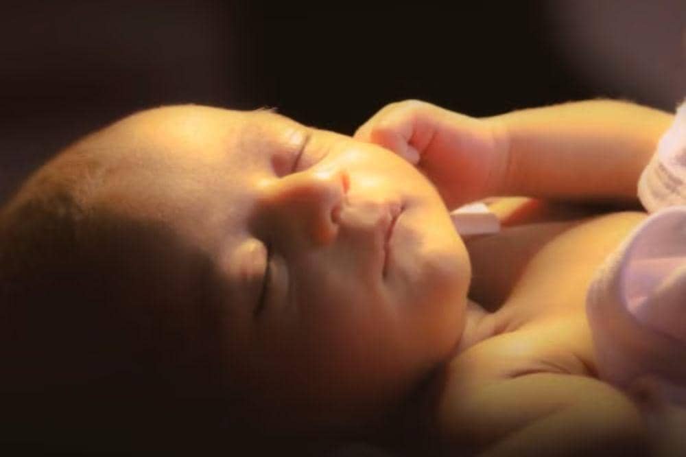 Pantau durasi atau lamanya warna kuning bertahan pada tubuh bayi