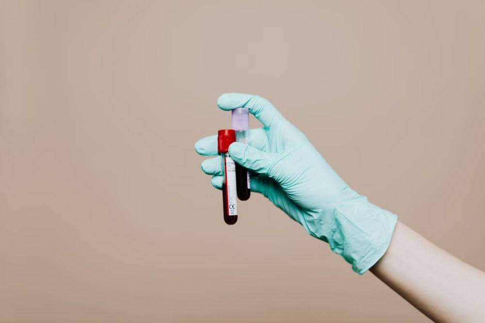 Bagaimana Dokter Mendiagnosis Karotenemia