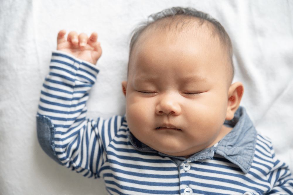 Cara Mengatasi Kepala Lonjong pada Bayi