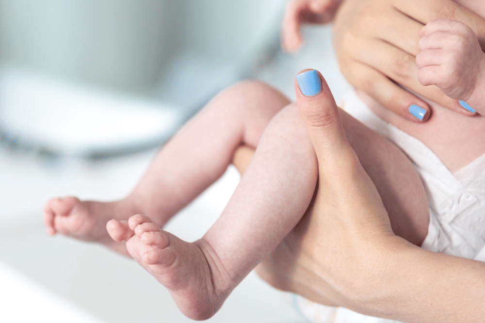 7 Daftar Cream untuk Menghilangkan Bintik Merah pada Bayi