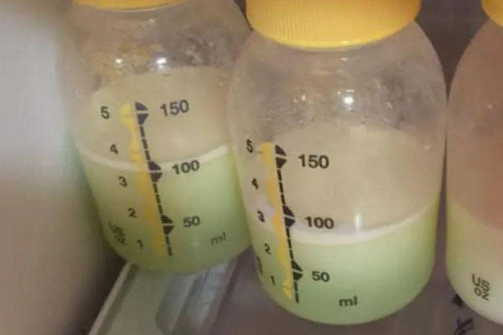 ASI Berubah Warna Jadi Hijau, Apakah Aman untuk Bayi?