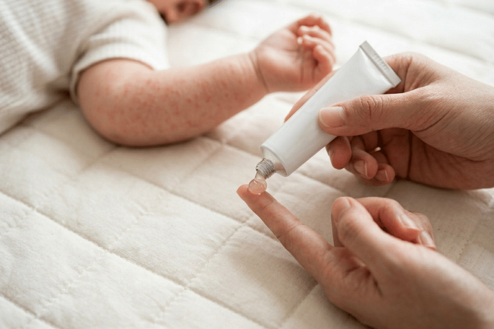 5 Rekomendasi Obat Salep Hydrocortisone untuk Bayi, Lengkap Harganya
