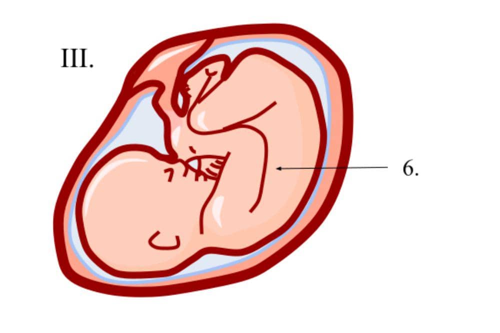 Infeksi pada tali pusar bayi