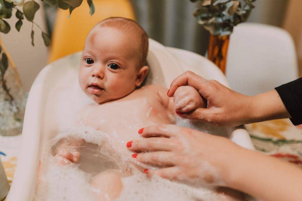 Terapi mandi pemutih (bleach bath) sesuai anjuran dokter 
