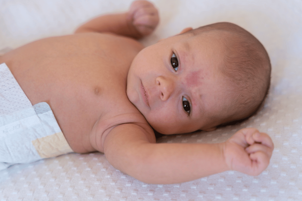 5 Hal pada bayi baru lahir yang terlihat 'seram', padahal normal.
