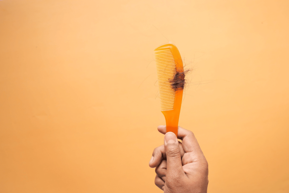 Siapa yang Bisa Mengalami Alopecia Areata?