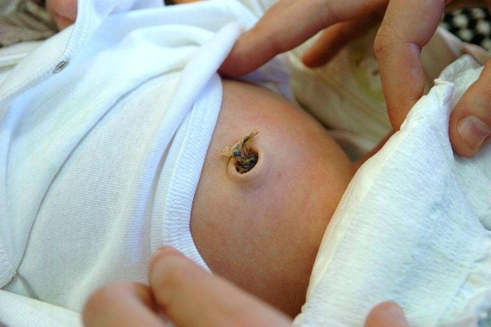Apakah Ada Tempat Tertentu untuk Menguburkan Tali Pusar Bayi