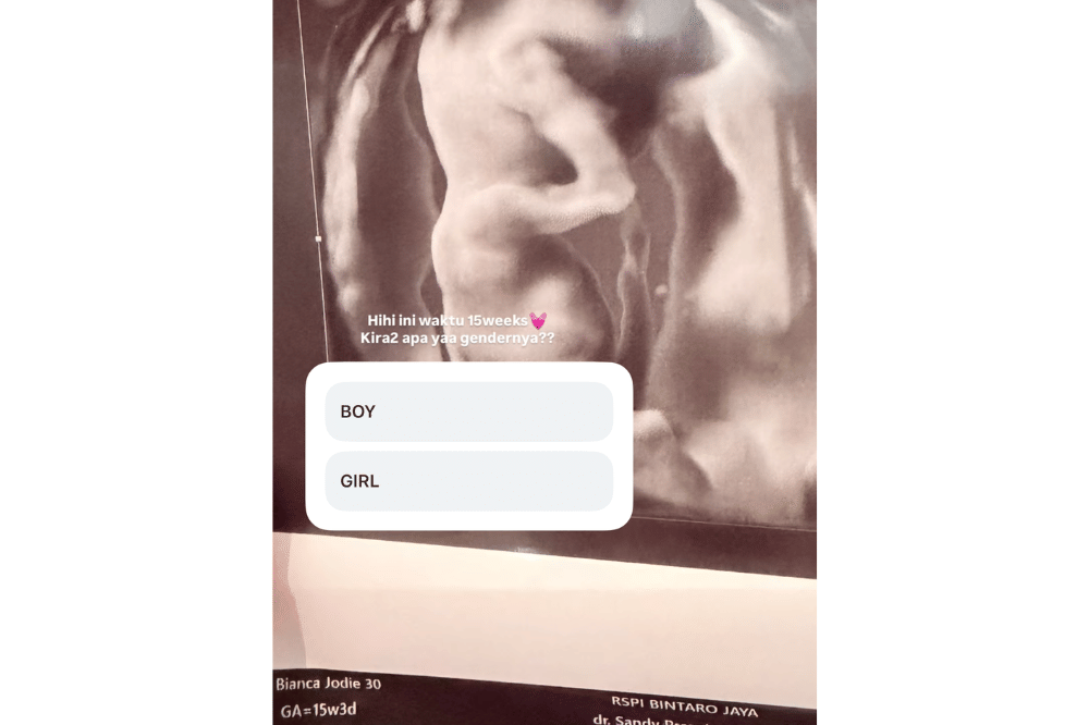 Brisia Jodie hamil anak pertama