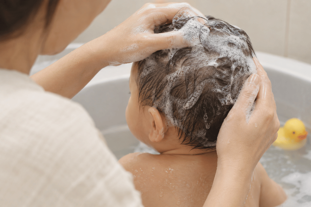 Perbedaan Penyebab Cradle Cap dan Ketombe Bayi