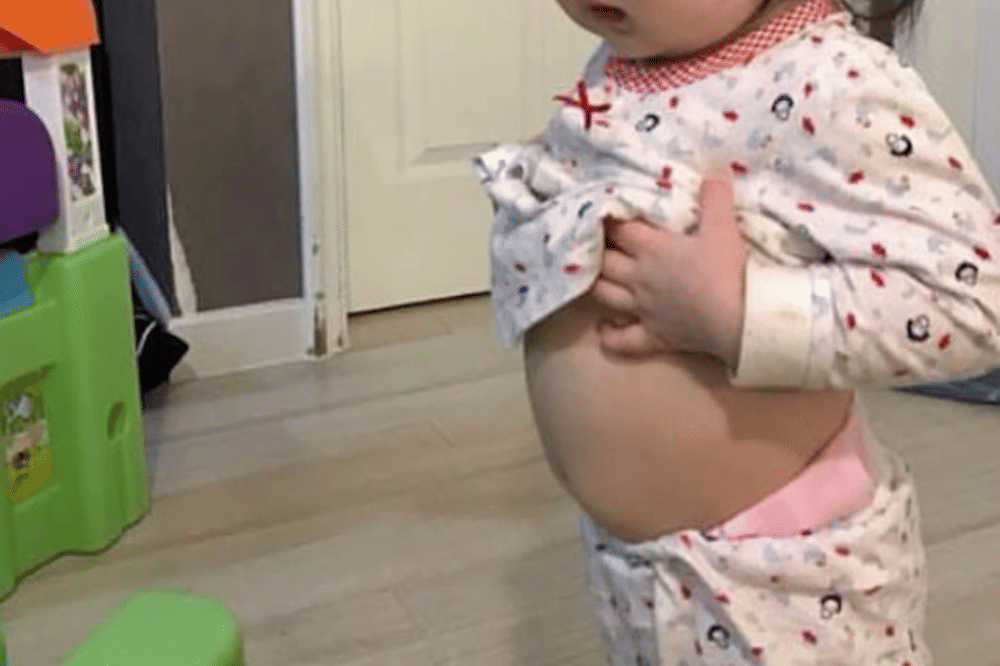 Cara meredakan perut kembung pada anak