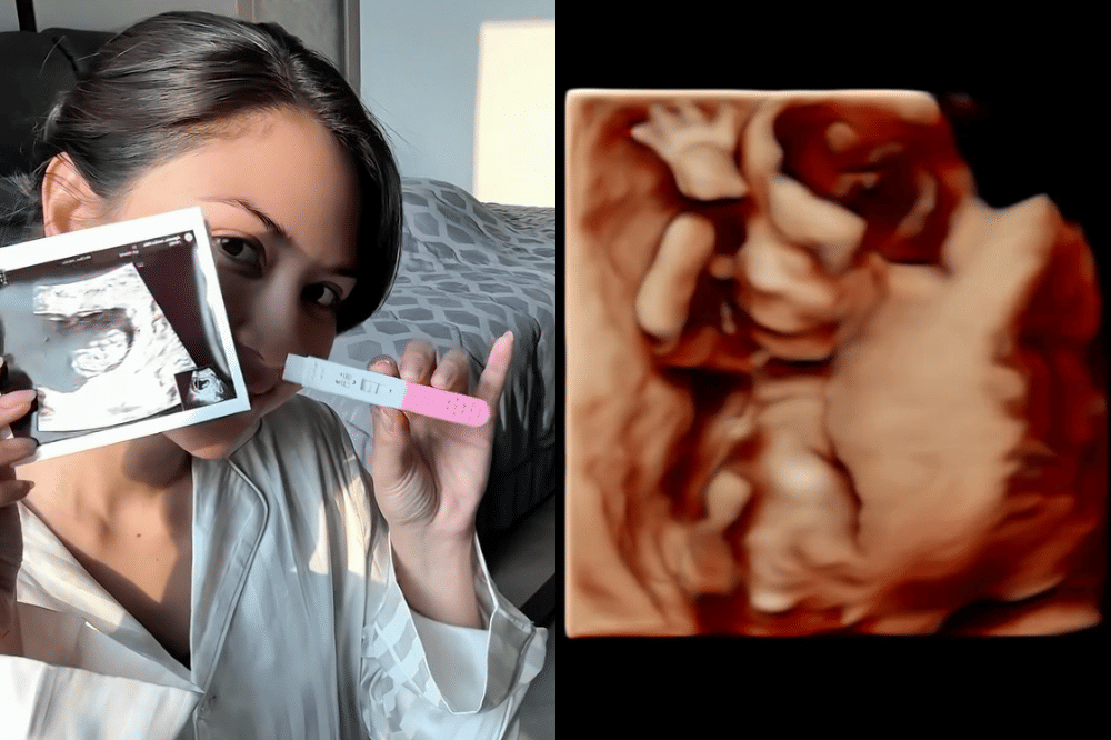 5 Fakta Kehamilan Kedua Jessica Mila, Berjarak 2 Tahun dari Anak Pertama