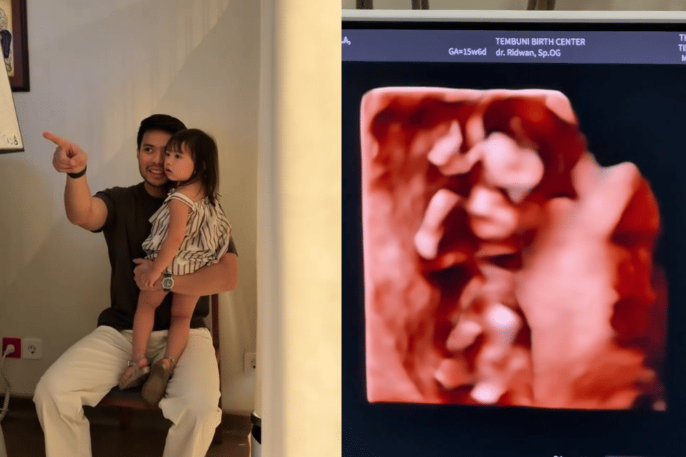 Jessica Mila hamil anak kedua