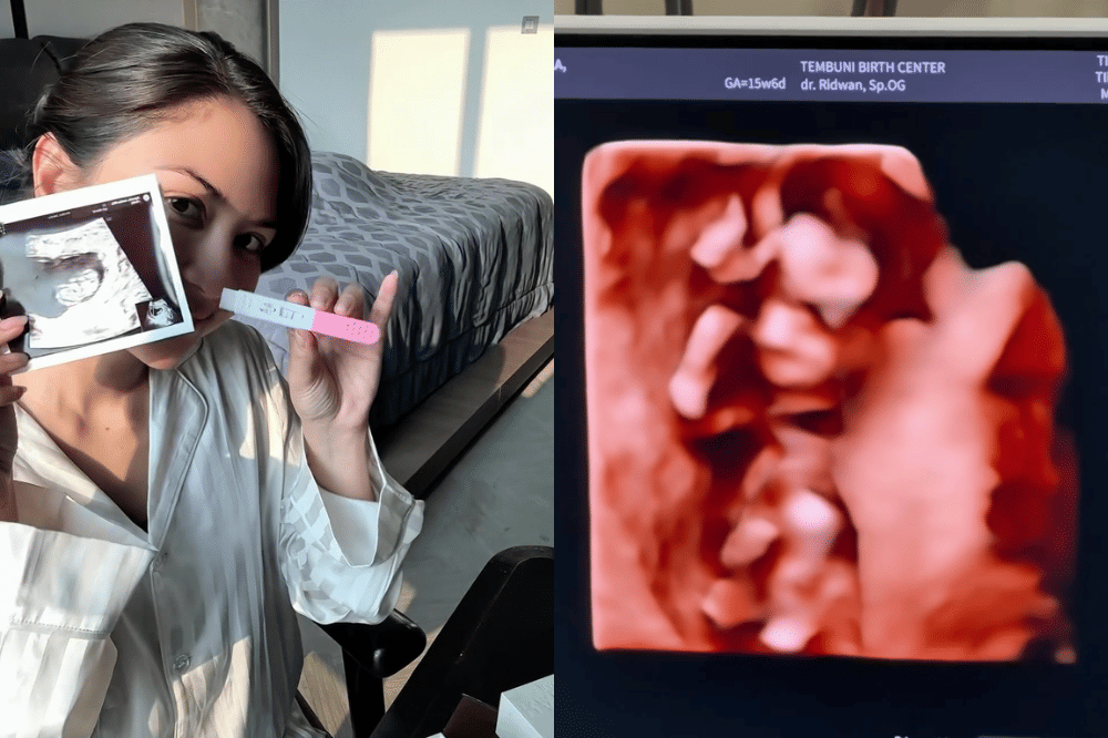 Jessica Mila Hamil Anak Kedua, Usia Kandungan Sudah 3 Bulan