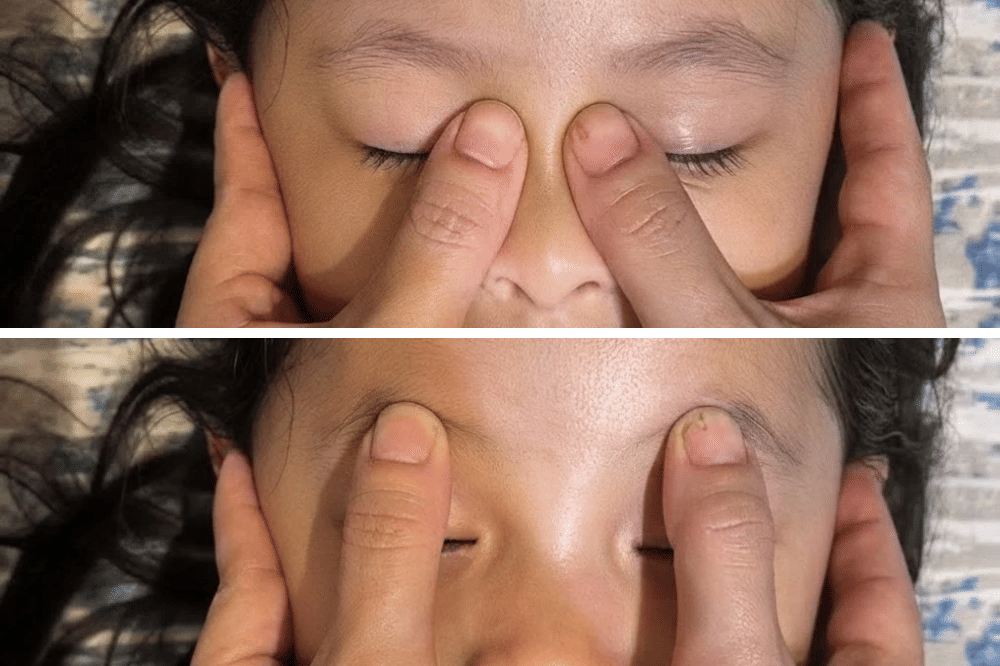 Pijatan area hidung dan alis pada anak